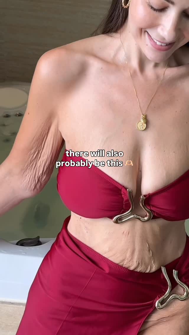 Part of the process ❤️‍🩹#bodyconfidence #looseskin #lipedema by @miss___jones