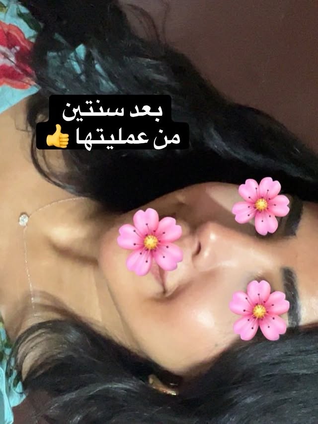 أشكر مراجعتي الكريمة على مشاركتها النتيجة 🙏🏻الله يهنيها @bashaierba3shen by @drsalharthi
