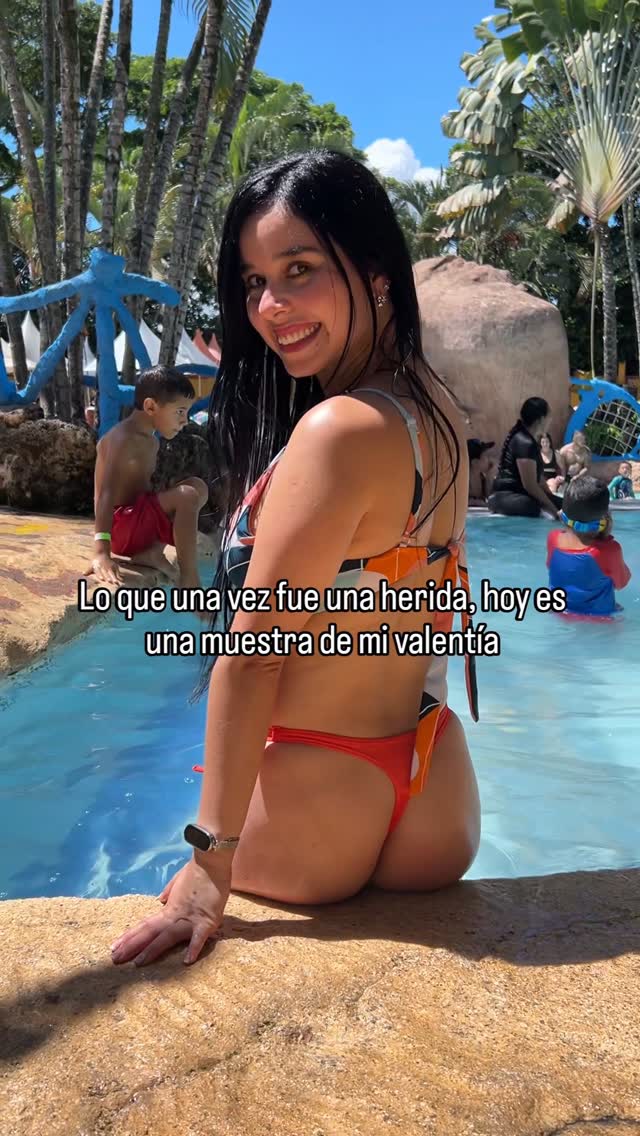 Cada marca en mi piel es un recordatorio de todo lo que fui capaz de superar