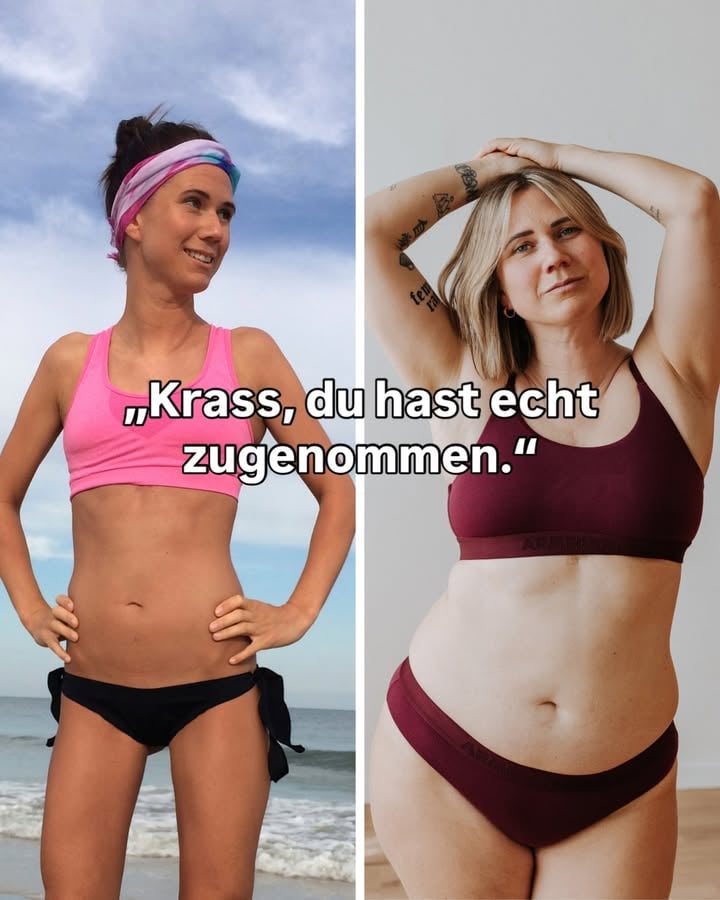 Ich mag den Trend sehr, denn meine Gewichtszunahme im Vergleich zu damals ist nichts, wofür ich mich schämen muss. Für mich war die Zeit, in der ich extrem dünn war, eine der ungesündesten Phasen in meinem Leben. 🥲 Inspo: @_nelly_london @alexlight_ldn @vikykid #UNSHAME #frausein #schönheit | Foto rechts: @junala_