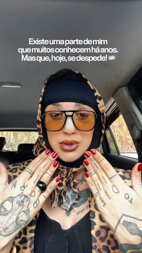 Por muitos anos, essa voz fez parte da minha vida e da minha trajetória profissional.

Com ela, construí carreira, me comuniquei, ensinei, apresentei projetos, participei de eventos e me conectei com milhares de pessoas.

Mas, assim como passei pelo meu processo de transição de gênero, a forma como eu me reconheço também mudou.

E com o tempo, essa voz passou a me causar disforia por carregar características que já não representavam a minha identidade de gênero.

Por isso, decidi que ela também precisava transicionar.

Hoje apresento uma voz mais alinhada com quem eu sou, com a mulher trans que me tornei e com a minha verdade.

#trans #transgender #cirurgia #explore #reels